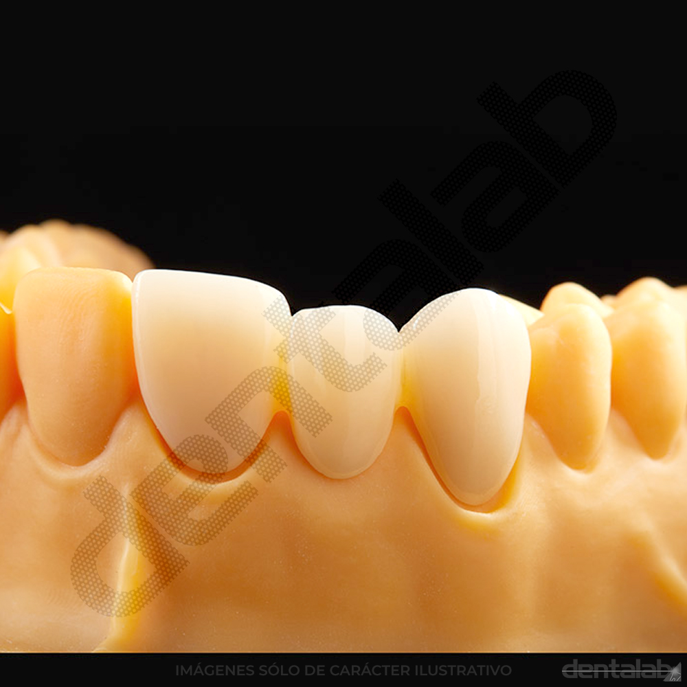 Disco de Zirconio RONDCERA SHT-ML PRO 3D A3.5 98 X 12mm
